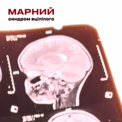 Обкладинка: Синдром вцілілого